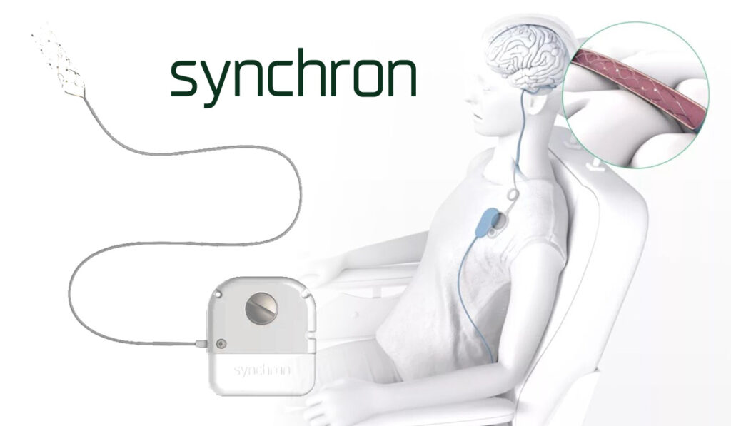 Illustration of Synchron’s brain-computer interface system, showing a neurotech implant connected from the brain to a chest-worn device, with a zoomed-in view of the brain-embedded stent-electrode array.